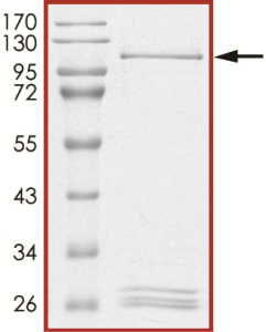 PKC beta I, Active